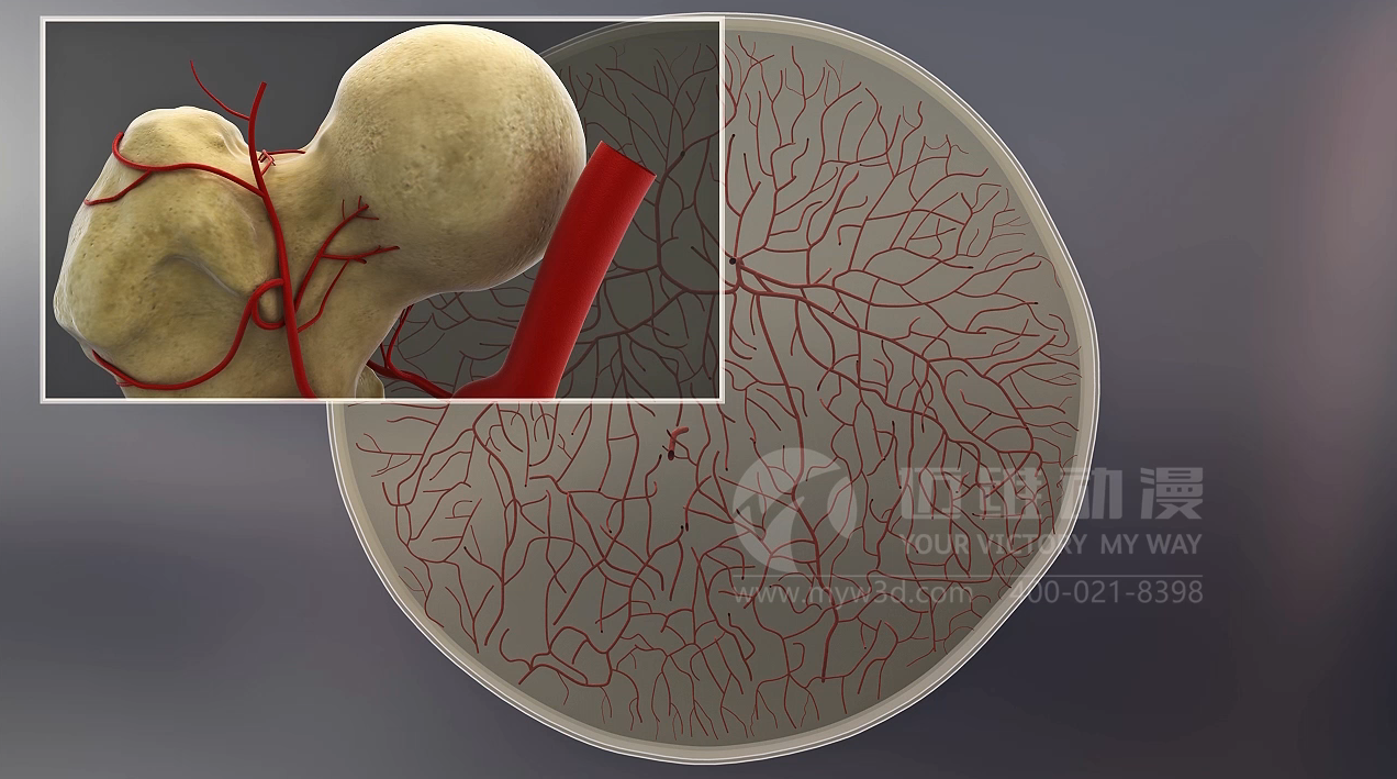 醫(yī)學(xué)醫(yī)療三維動(dòng)畫 醫(yī)學(xué)醫(yī)療三維動(dòng)畫