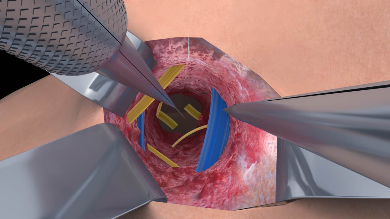 醫(yī)療醫(yī)學三維動畫.jpg 醫(yī)療醫(yī)學三維動畫.jpg