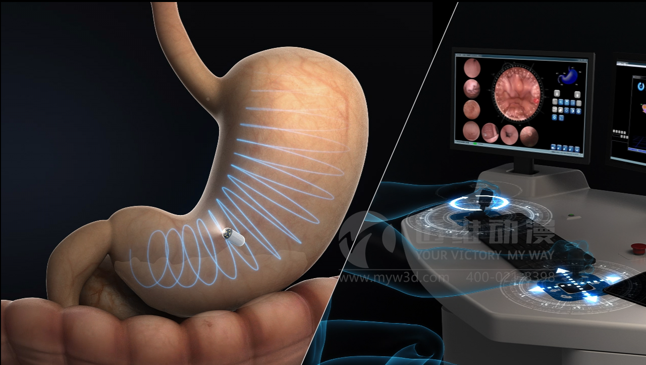 醫(yī)學(xué)醫(yī)療三維動(dòng)畫在醫(yī)療行業(yè)中的應(yīng)用及優(yōu)勢(圖1) 醫(yī)學(xué)醫(yī)療三維動(dòng)畫在醫(yī)療行業(yè)中的應(yīng)用及優(yōu)勢(圖1)