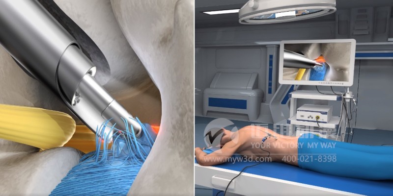 三維動畫給醫(yī)學(xué)領(lǐng)域帶來哪些便利？(圖4)