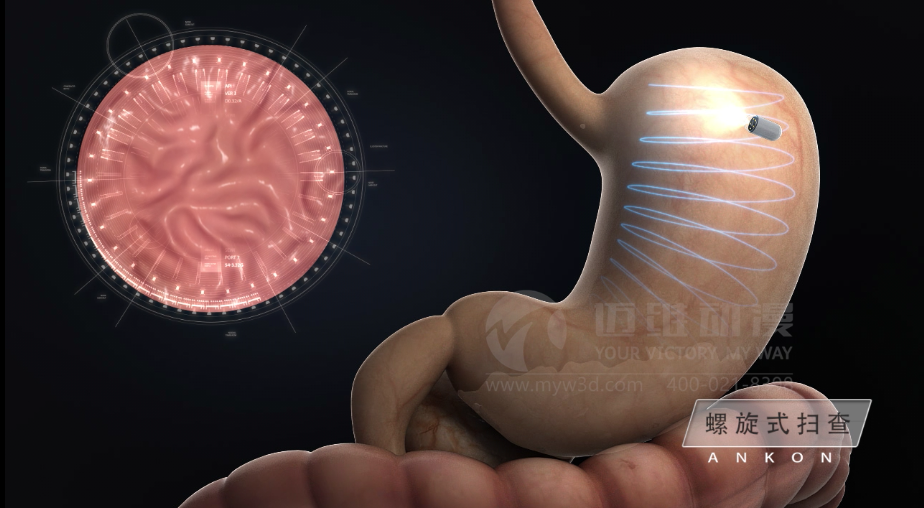 醫(yī)用設(shè)備三維動畫制作好處有哪些？(圖2)