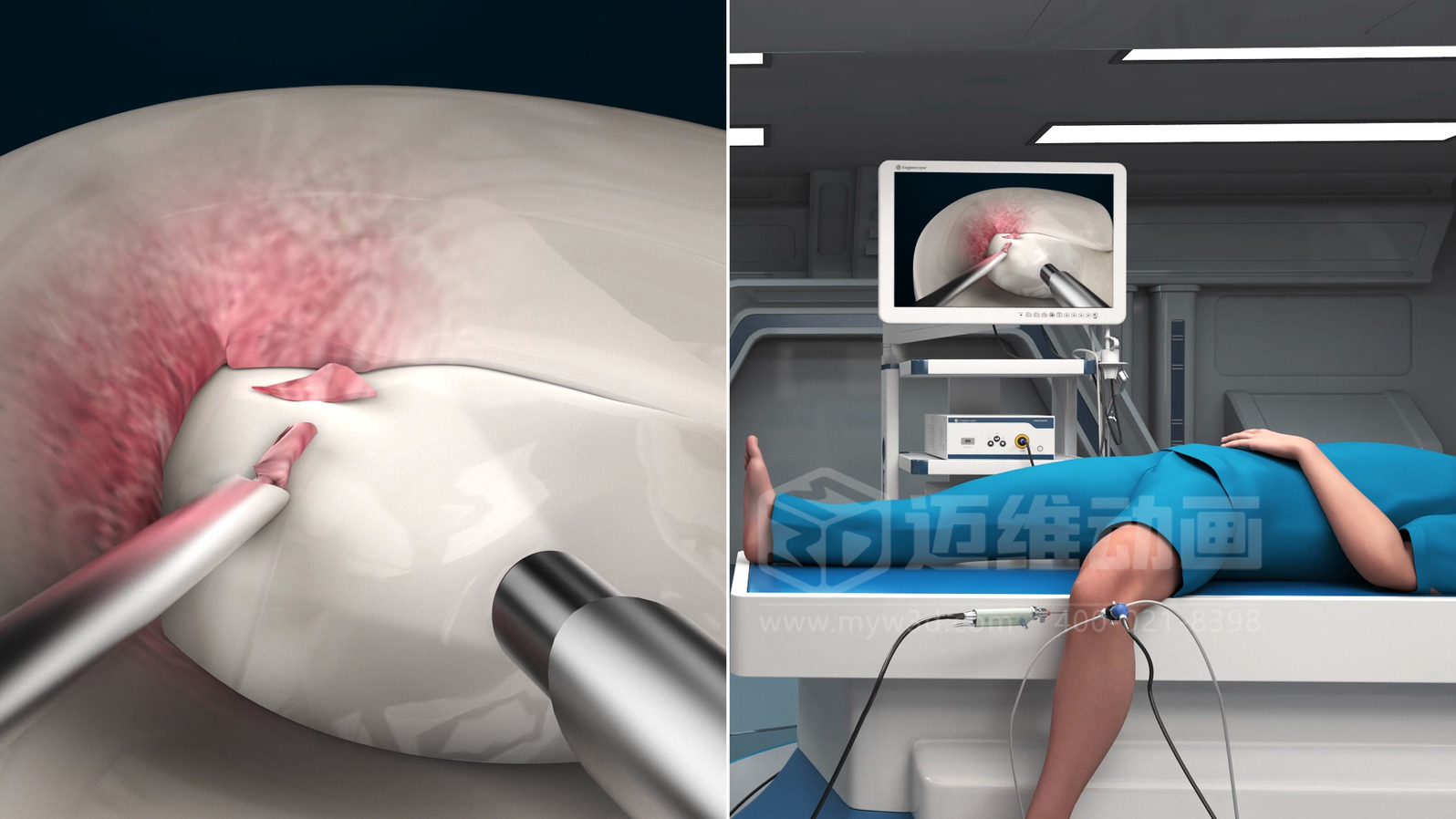 醫(yī)學手術(shù)三維動畫制作公司哪家好？解碼上海邁維動漫的醫(yī)學醫(yī)療3D可視化創(chuàng)新之路(圖2)