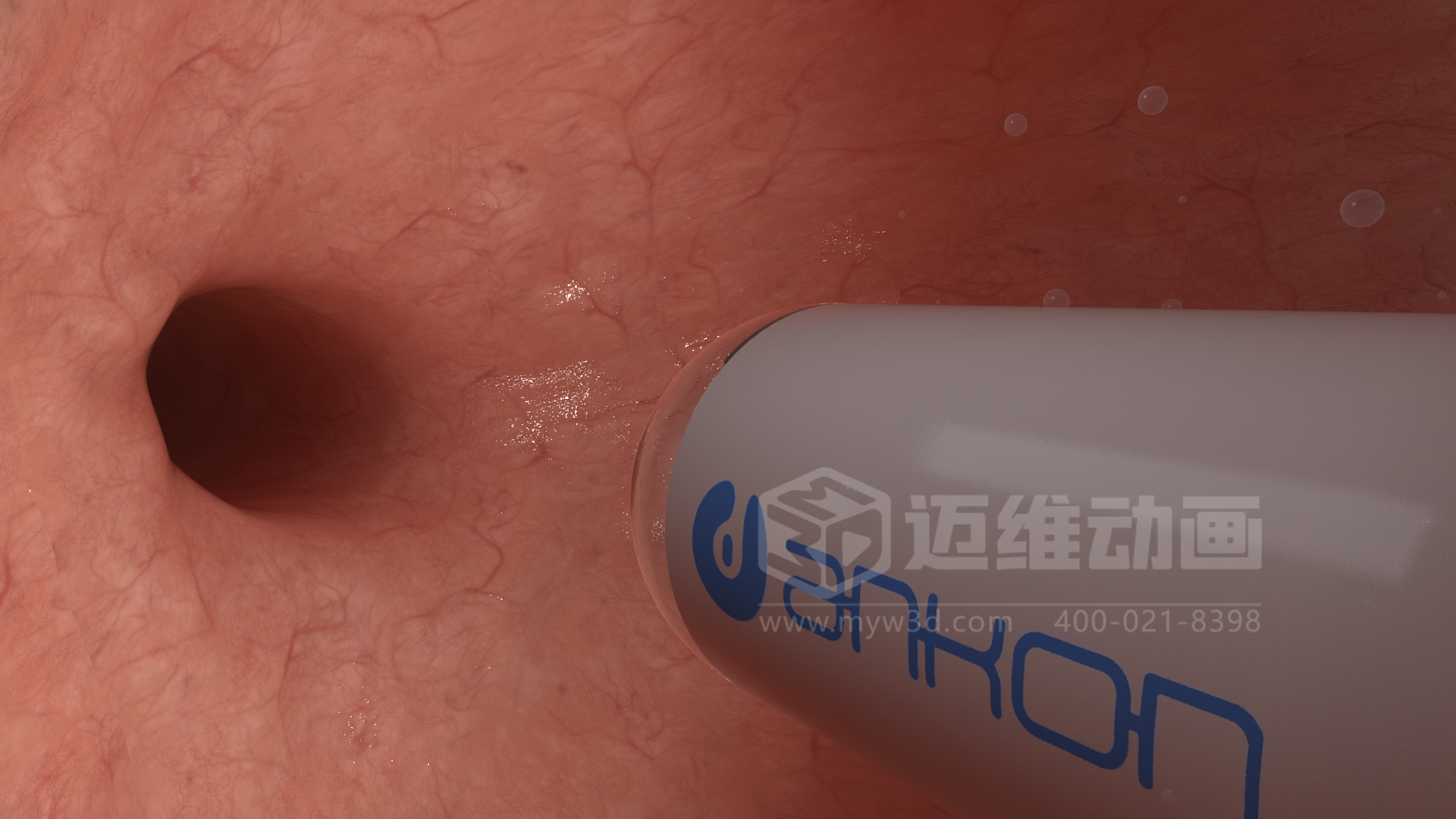 醫(yī)學(xué)檢測設(shè)備如何突破消化道檢查壁壘？三維動畫還原核心技術(shù)與臨床價值(圖4)